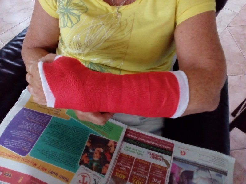 Arm in het gips